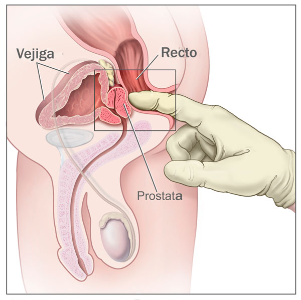 Ubicacion prostata